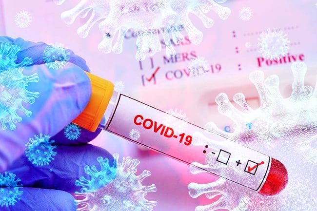 யாழில் மேலும் மூவர் கொரோனாத் தொற்றால் பலி!