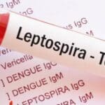 71fcedbd 53efa748 leptospirosis 850x460 acf cropped