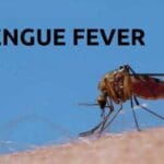 dengue fever