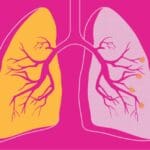 9133 COPD Facts Statistics and You 1296x728 Header