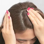Dandruff 302eff98 558b 4891 8161 a3f9e13e0026 1024x400 1