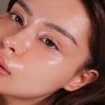 1773399 oily sikin 1