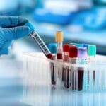 blood test samples 1200x750 59cd6b99366c6e716576ccd68351ed39
