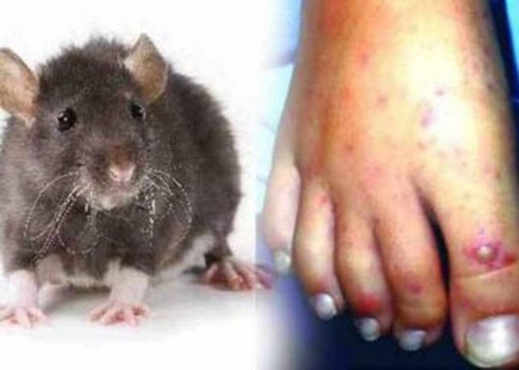 Q9CK6RRNH6y5wOdYINDk 1