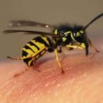 What to Do if Youve Been Stung by a Wasp or Bee