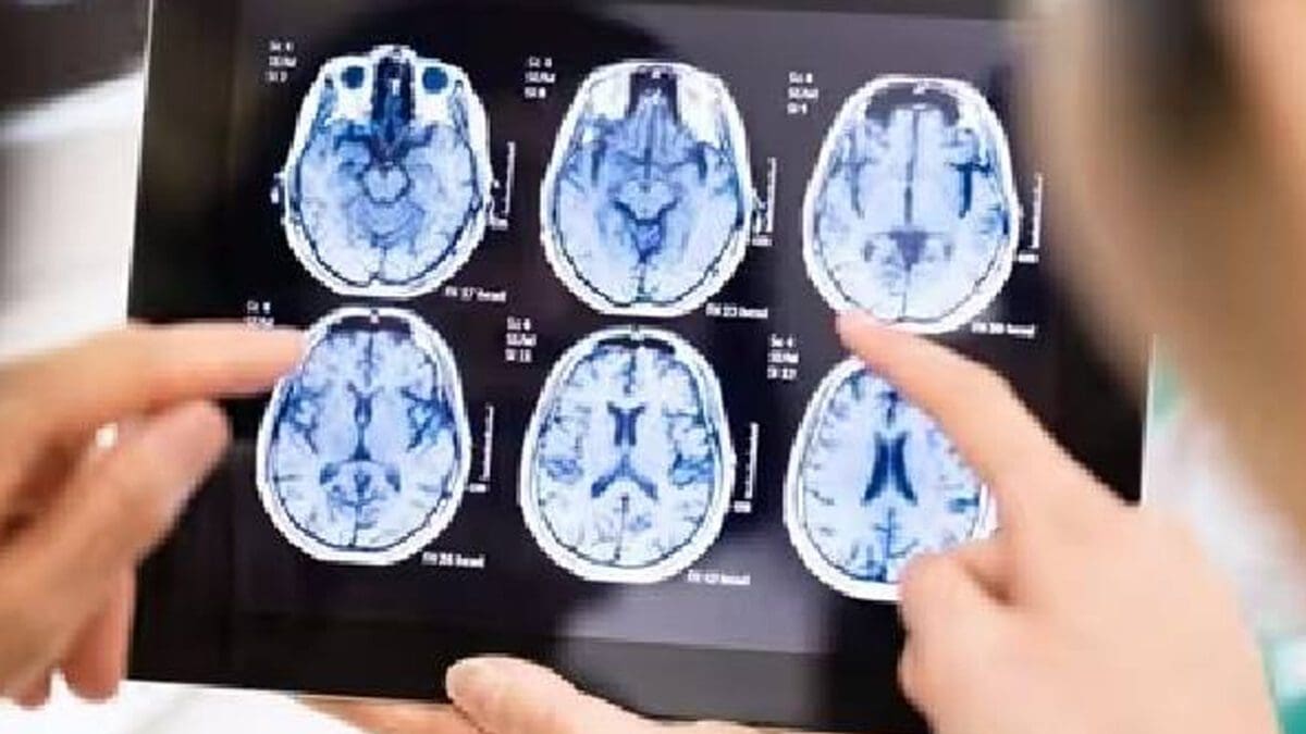 மூளையை உண்ணும் அமீபா! கேரளாவில் 15 வயது சிறுவன் உயிரிழப்பு