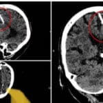 tamilni Recovered Recovered 9