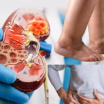 kidney 2025 02 64c4dfaad03050762c0097e951e0a6ec 3x2 1