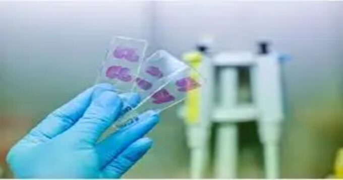 Histopathological examination