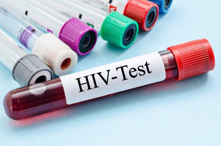 நாட்டில் அதிகரிக்கும் எச்.ஐ.வி தொற்றாளர்கள் 1 01 HIV AIDS