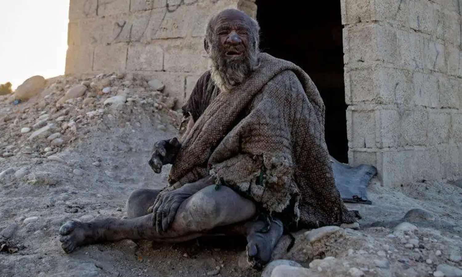 உலகின் அழுக்கு மனிதர் மரணம்! 1 dirty1
