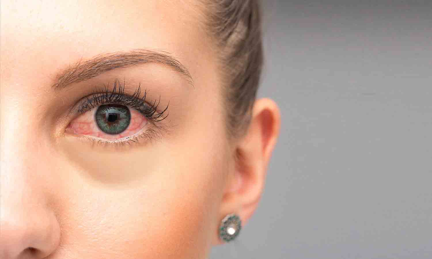 கண்கள் காட்சி அளிக்கின்றனவா? - உங்களுக்காக இது 1 1794162 if the eyes show red color